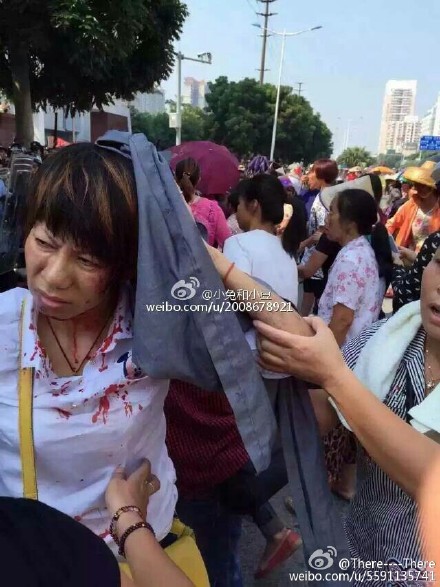 A protester was injured in clashes on Thursday. Photo; Weibo.