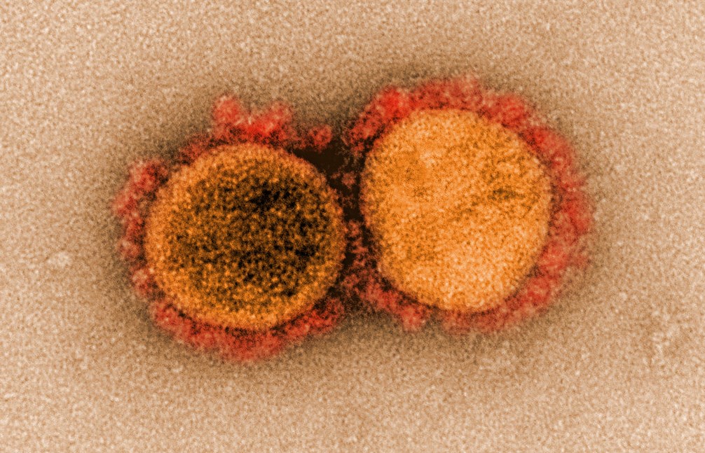 coronavirus covid-19 microscope virus cell