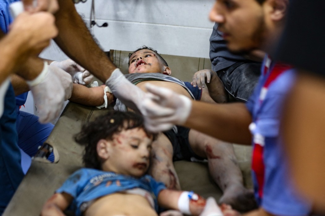 Children injured in an Israeli strike receive emergency medical care at the Al-Shifa hospital in Gaza City on October 15, 2023. Israel embarked on a withering air campaign against Hamas militants in Gaza after they carried out a brutal attack on Israel on October 7 that left more than 1,400 people killed in Israel. Photo: Dawood Nemer/AFP.